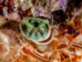   Eye  